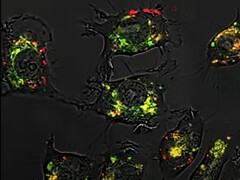 Благодаря сферическим нуклеиновым кислотам соединение 5-фторурацил оказалось в 20 000 раз эффективнее, чем обычно в исследованиях на животных. (Источник изображения: Северо-Западный университет)