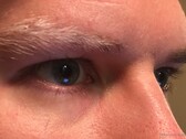 Забота о здоровье глаз в эпоху высоких технологий