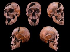 Череп исследуемого человека из доминиканского монастыря 13-го века на острове Маргарет, Будапешт (Image Credit: Eötvös Loránd University)