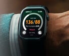 Часам Watch D2 уже почти два года.