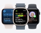пришла watchOS 26, которая принесла множество новых функций на часы Apple Watch. (Источник изображения: Apple)