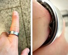 Samsung Galaxy Ring со вздувшимся аккумулятором заставил пользователя отправиться в больницу. (Источник изображения: Zone of Tech)