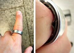 Samsung Galaxy Ring со вздувшимся аккумулятором заставил пользователя отправиться в больницу. (Источник изображения: Zone of Tech)