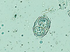 Toxoplasma gondii показана здесь в своей инфекционной яйцеподобной форме. (Источник изображения: Todorean Gabriel/iStock/Getty Images Plus)