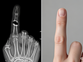 Bone Biologics подает патент на новую технологию регенерации костей (Источник изображения: Иллюстративное изображение, созданное искусственным интеллектом)
