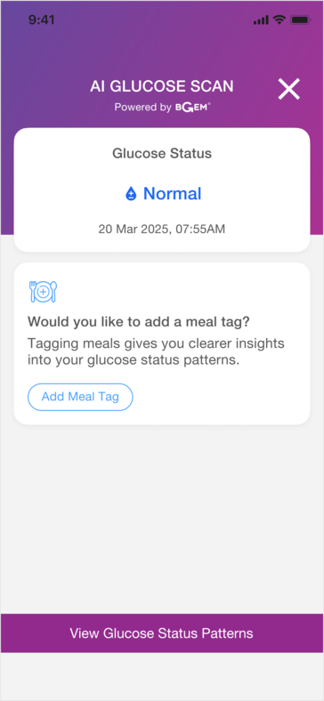 Умное кольцо может быть полезно для обнаружения связи между определенными продуктами питания и уровнем сахара в крови пользователя