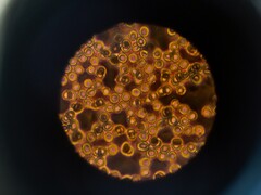 Клетки крови под микроскопом (Источник изображения: ThisisEngineering via Unsplash; обрезано)